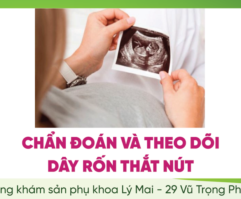 CHẨN ĐOÁN VÀ THEO DÕI DÂY RỐN THẮT NÚT.