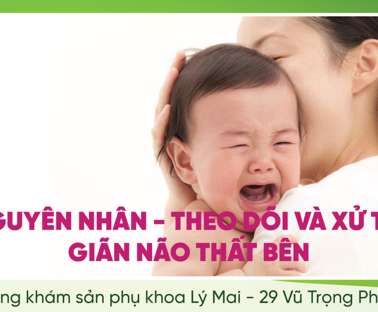 GIÃN NÃO THẤT BÊN: NGUYÊN NHÂN – THEO DÕI VÀ XỬ TRÍ