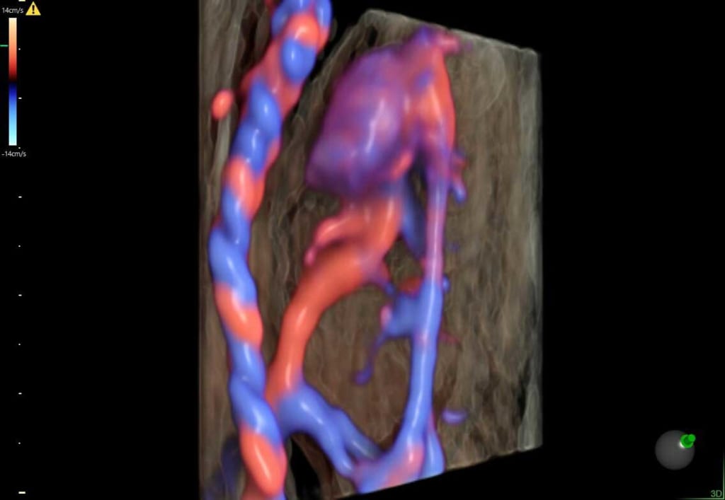 Siêu âm hệ tuần hoàn thai nhi