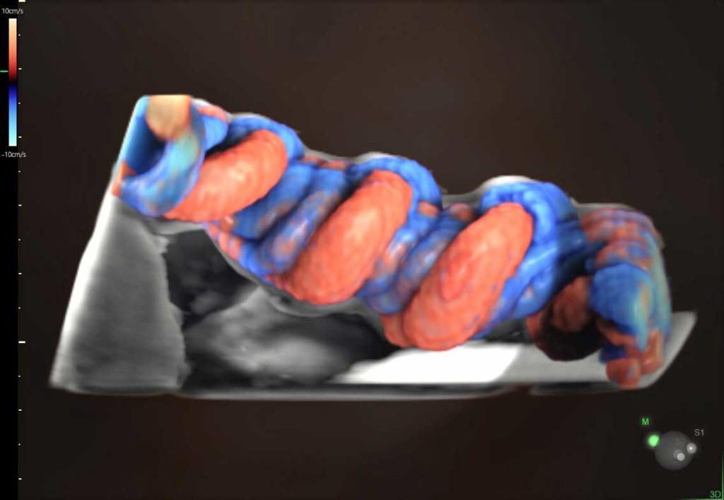 Hình ảnh dây rốn